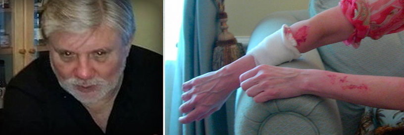 Mike Rinder and his wife's arm after Mike beat her